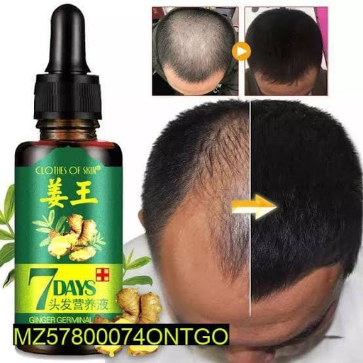 7 Day Hair Growth Germinal Oil, 30 Ml